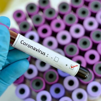 /media/17711/coronavirus.jpg